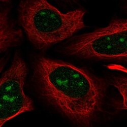 Nova1 Antibody, Novus Biologicals 25 &mu;L | Buy Online | Novus Biologicals | Fisher Scientific